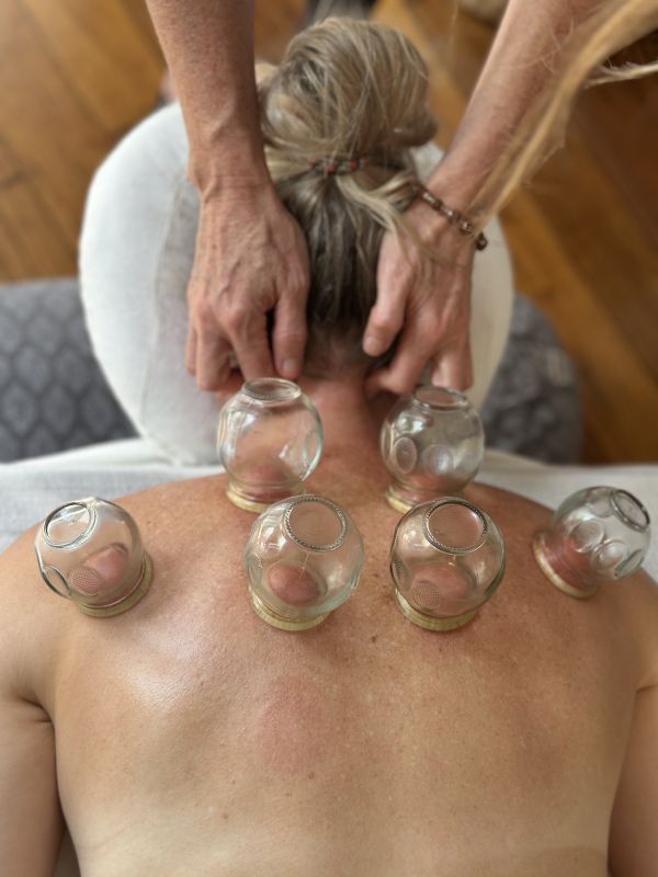 Cupping